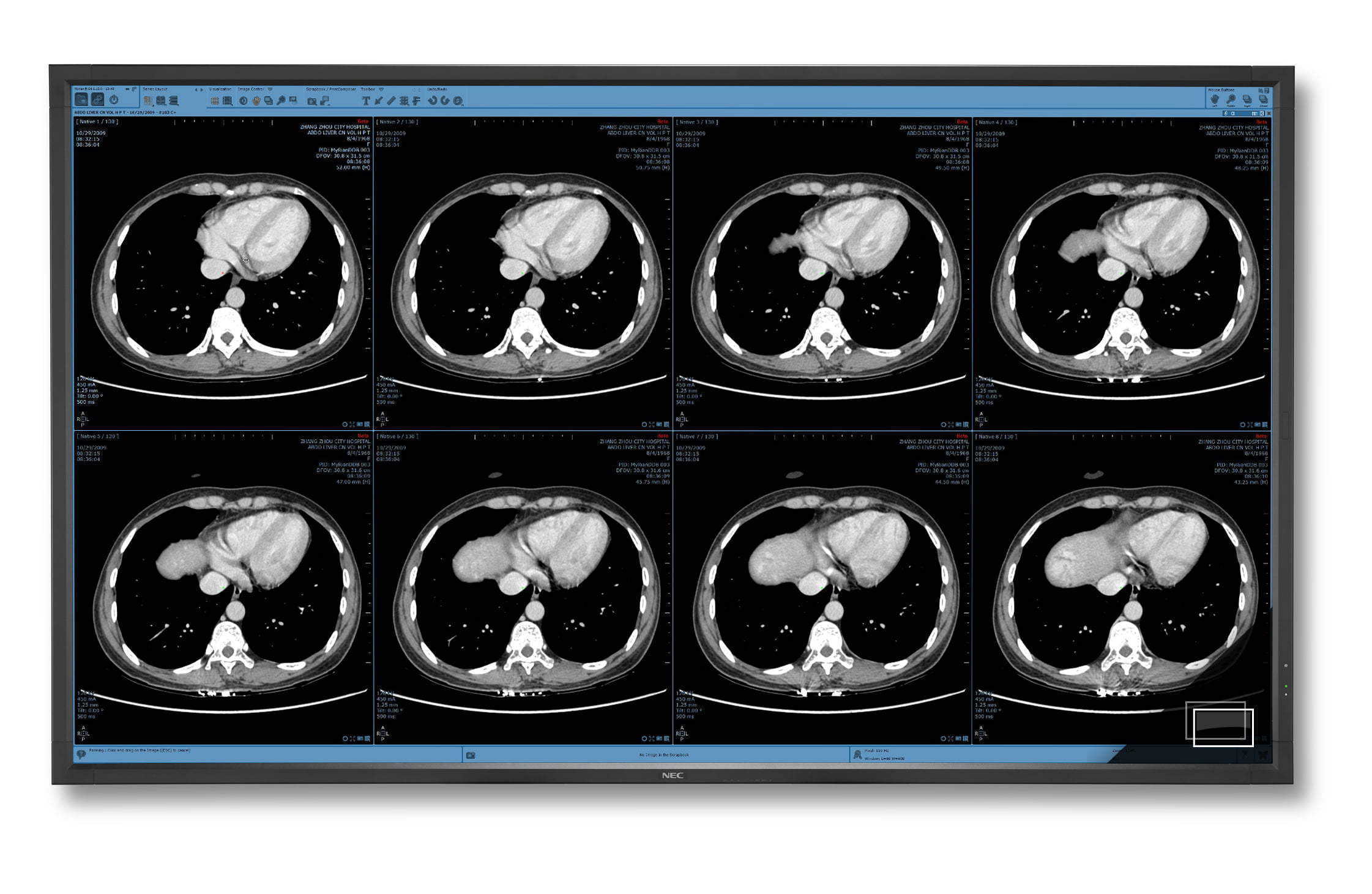 NEC_X841UHD_PG_HO_RGB_300_medical-content-highres